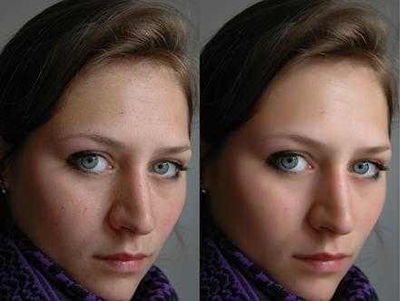 retouch_before-after