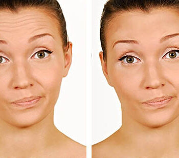 remove wrinkles photoshop before after